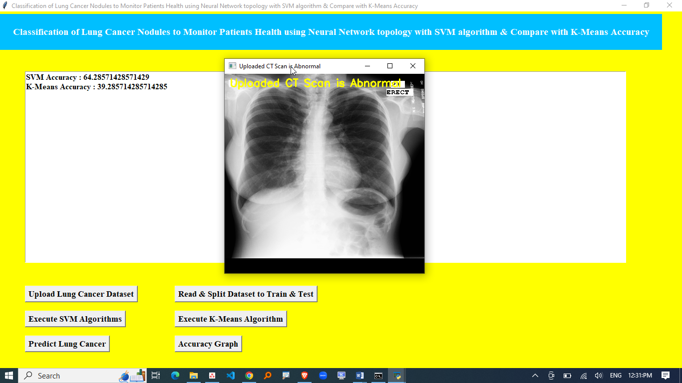DETECTION OF LUNG CANCER FROM CT IMAGE