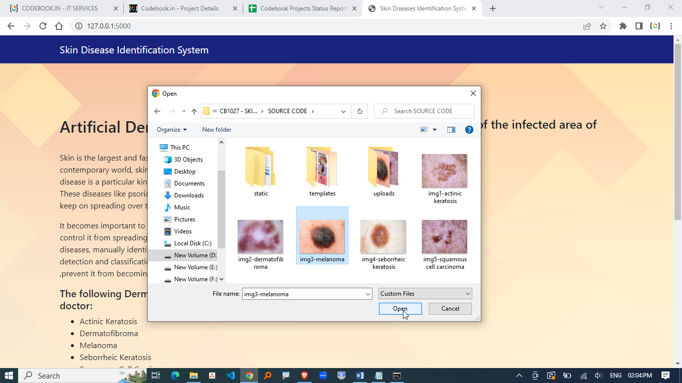 SKIN DISEASES DETECTION USING DEEP LEARNING